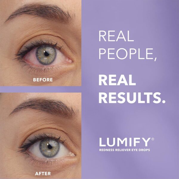 LUMIFY Redness Reliever Eye Drops, For Whiter & Brighter Looking Eyes, - Image 2