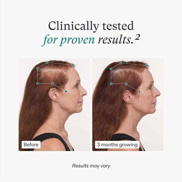 Nutrafol Women's Balance Hair Growth Supplements, Ages 45 and Up, Clinically Proven for Visibly Thicker Hair and Scalp Coverage, Dermatologist Recommended - 1 Month - Image 4